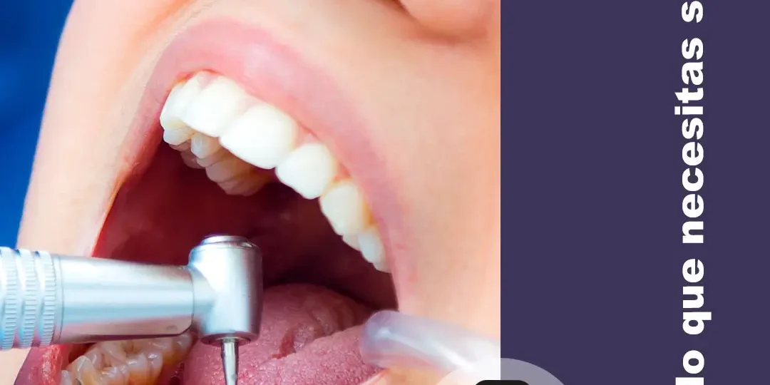 Importancia de una limpieza dental