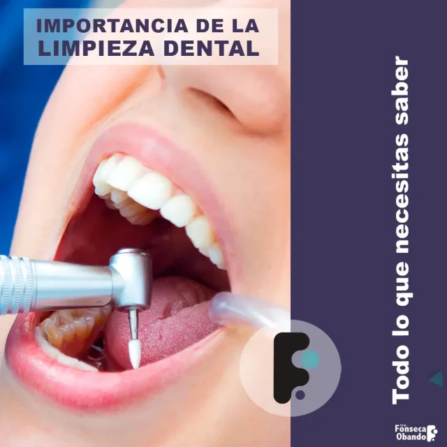 Importancia de una limpieza dental