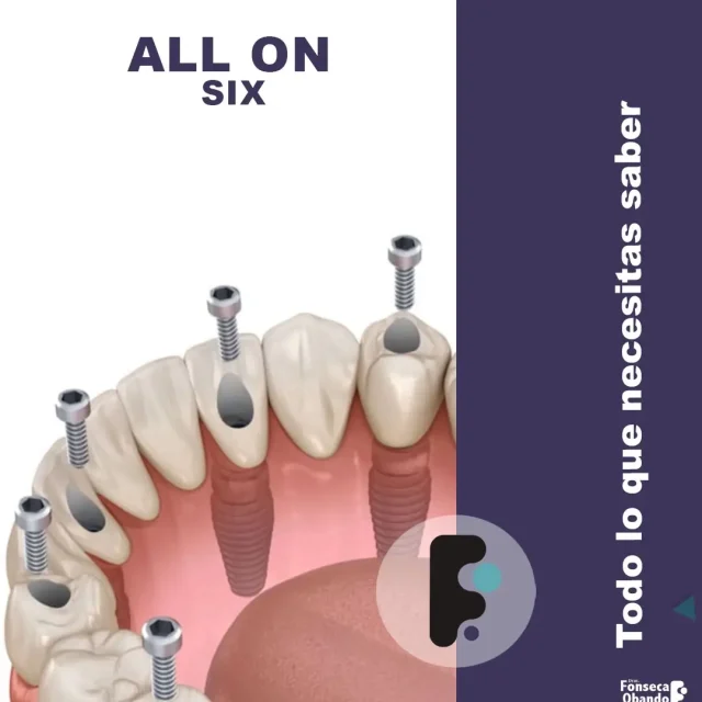 All on six