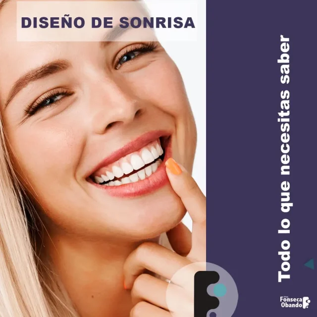 Diseño de sonrisa