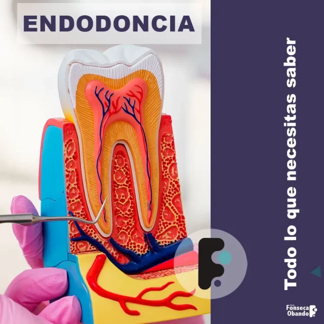 Endodoncia
