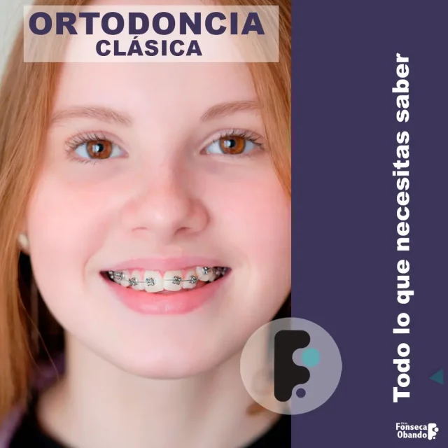 Ortodoncia clásica