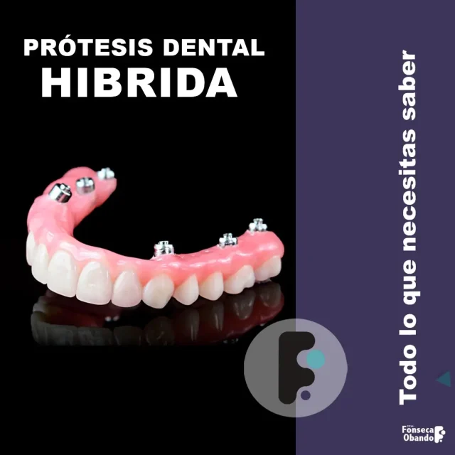 Prótesis Hibrida