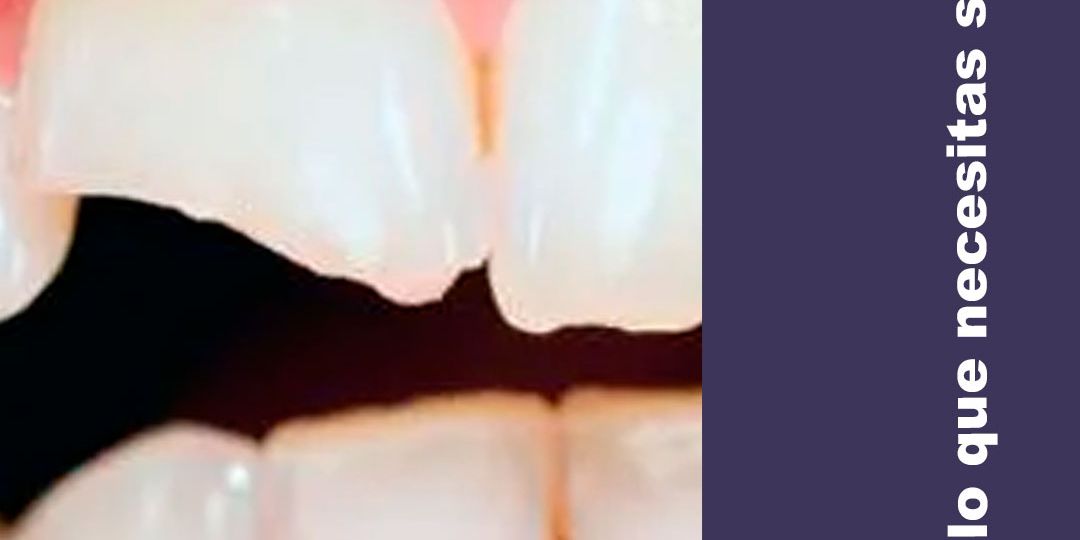reconstrucción dental