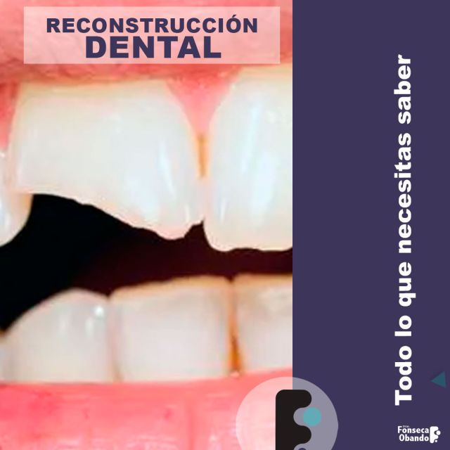 reconstrucción dental