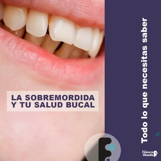 Cómo afecta la sobremordida a tu salud bucal