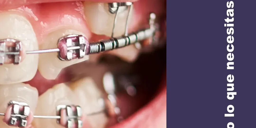 Ortodoncia y reconstrucción denta