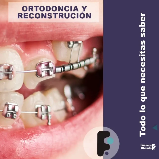 Ortodoncia y reconstrucción denta