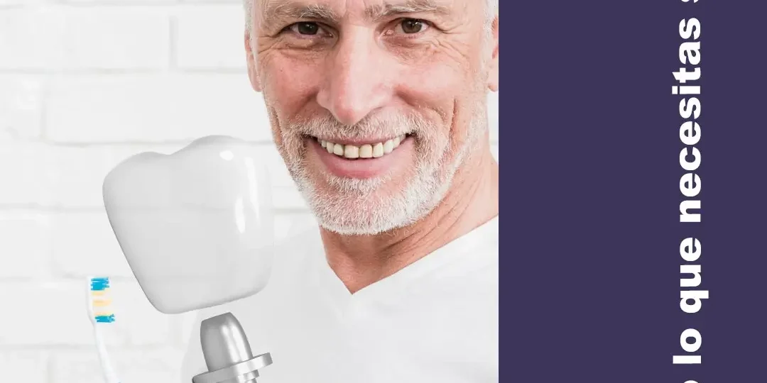 Cómo cuidar tus implantes dentales