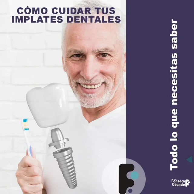Cómo cuidar tus implantes dentales