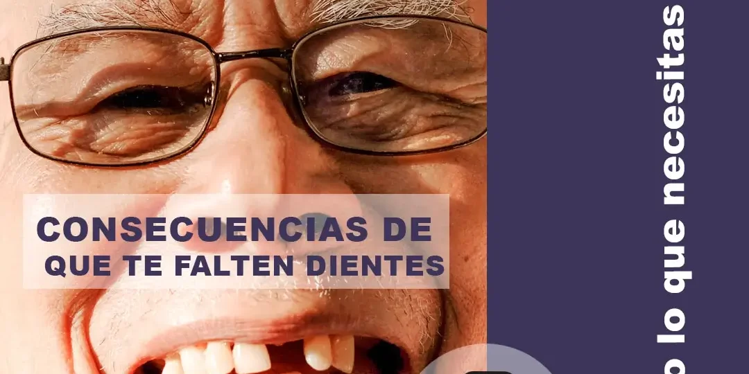 Consecuencias de que te falten dientes