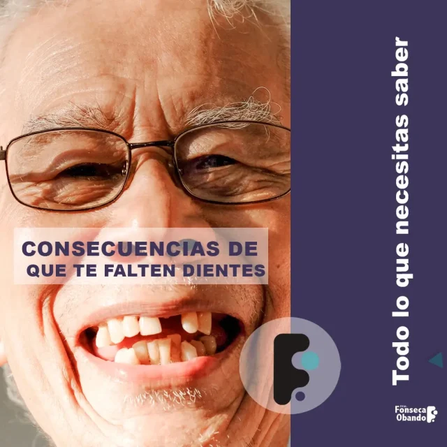 Consecuencias de que te falten dientes