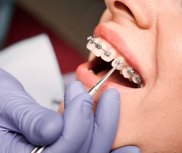 Ortodoncia con Brackets en General Ricardos