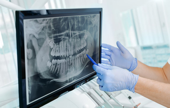 Radiología Dental en General Ricardos