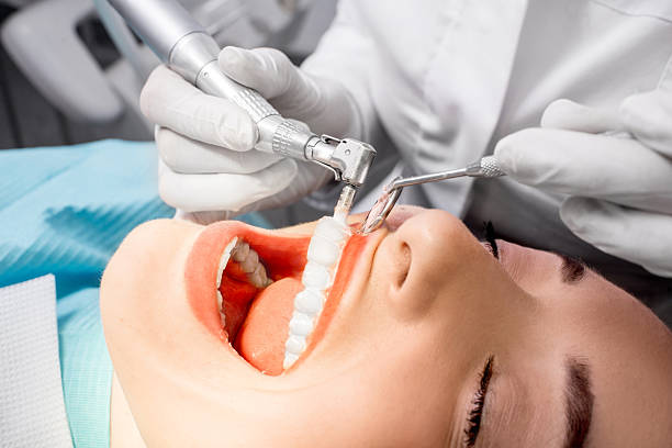 limpieza dental en general ricardos limpieza dental en general ricardos